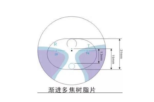 美麗島多焦鏡適合的人群，需要注意的事項